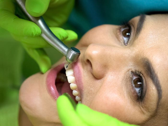 dentist preparing tooth for sealant placement