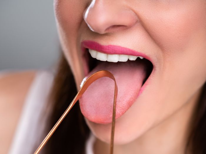 hiv bumps under tongue